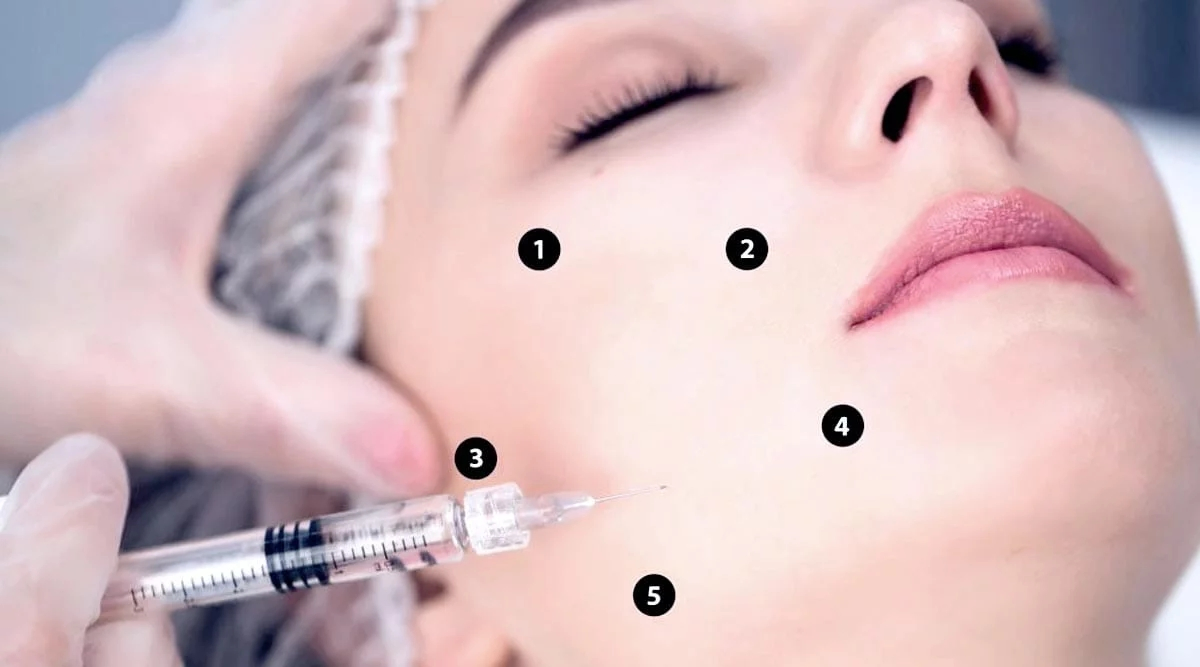 Wholesale Safe and Effective Face Lifting H+L Ha Molecular Profhilo Injectable Dermal Filler Profhilo for Winkle Removal