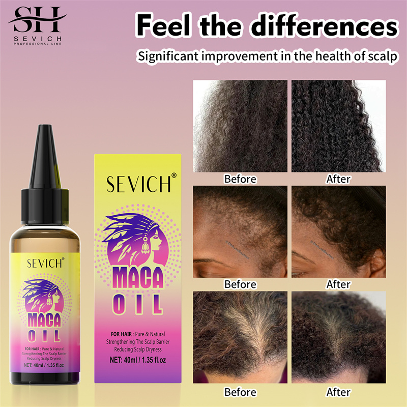 Reducing Scalp Dryness Maca Power Hair 40ml Maca Power Hair Oil