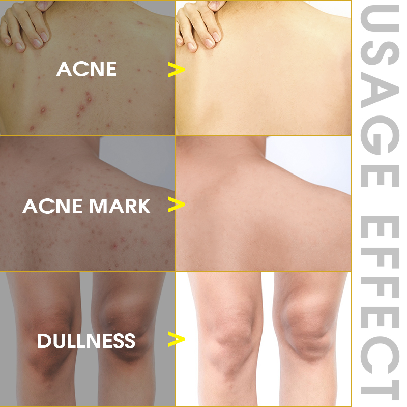 Private Label Face Body Dead Skin Peel off Shea Butter Exfoliating Brightening Scrub