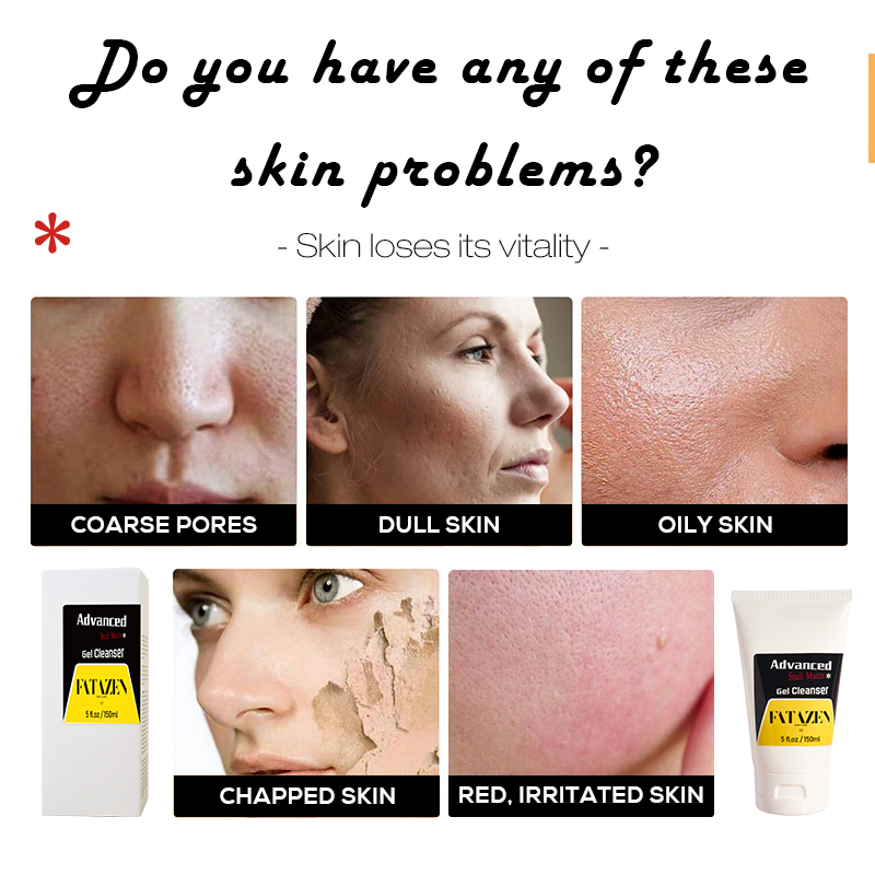 Deep Cleansing Moisturizing Anti Acne Treatment Smoothing Foaming Snail Facial Cleanser