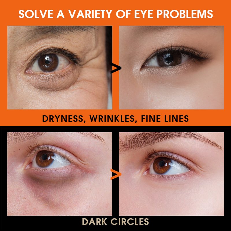 High Purity Remove Dark Circles Anti Wrinkle Puffiness Gel Vitamin C Eye Cream