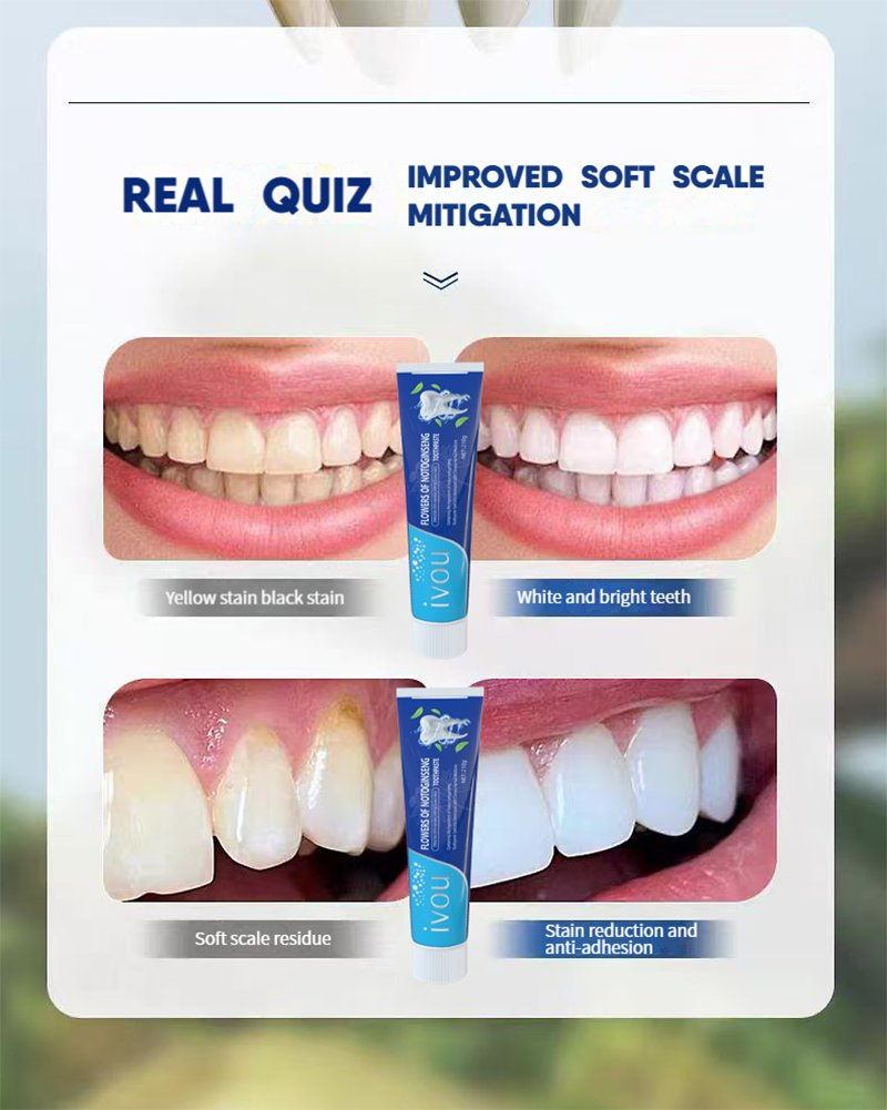 Plant Extract Panax Notoginseng Flower Toothpaste