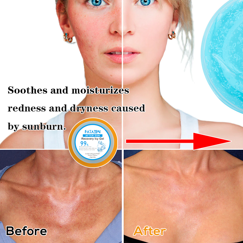 Moisturizing Rapid Repairing After Sun Whitening Anti-Aging Ice Gel Facial Cream