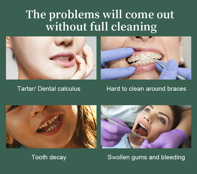 High Pressure Irrigator Home Use Travel Portable Water Flosser