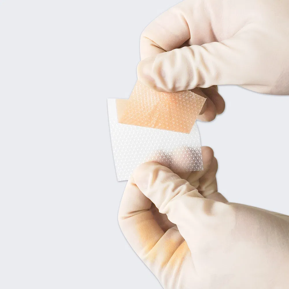 Large C Section Silicone Scar Sheets Medical Grade Silicone Scar Tape Jumbo Roll for Surgical Scars