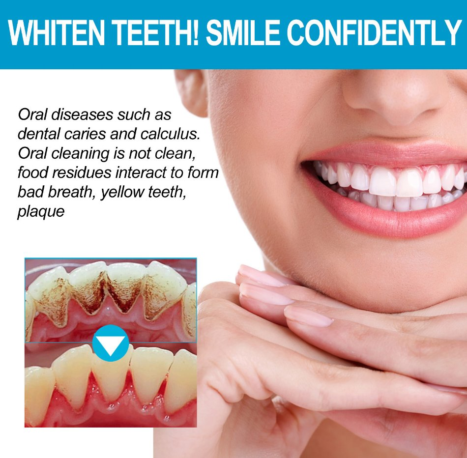 Online Wholesale and Retail Natural Alcohol Free Eco-Friendly Remove Teeth Stains Fresh Breath Teeth Whitening 5PCS Portable Jelly Cup Dental Mouthwash