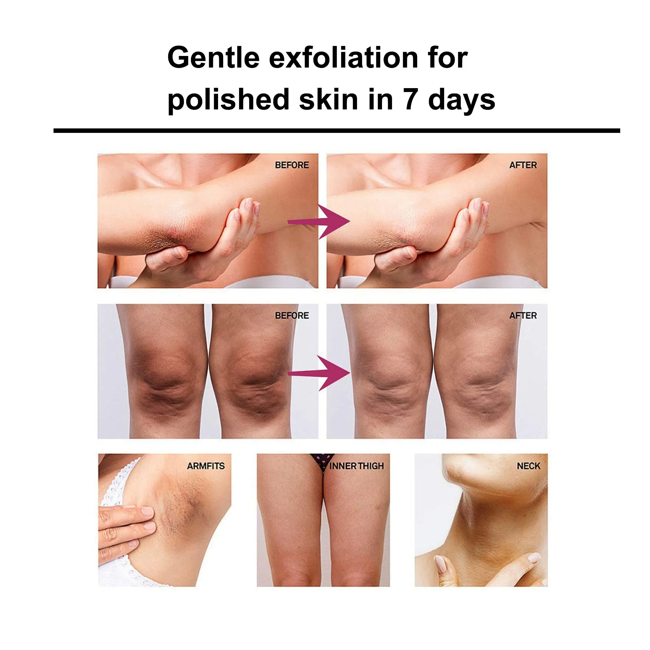 Roushun Whitening Professional Exfoliating Deep Cleaning and Softening Facial and Body Kojic Acid Sugar Scrub for Skin