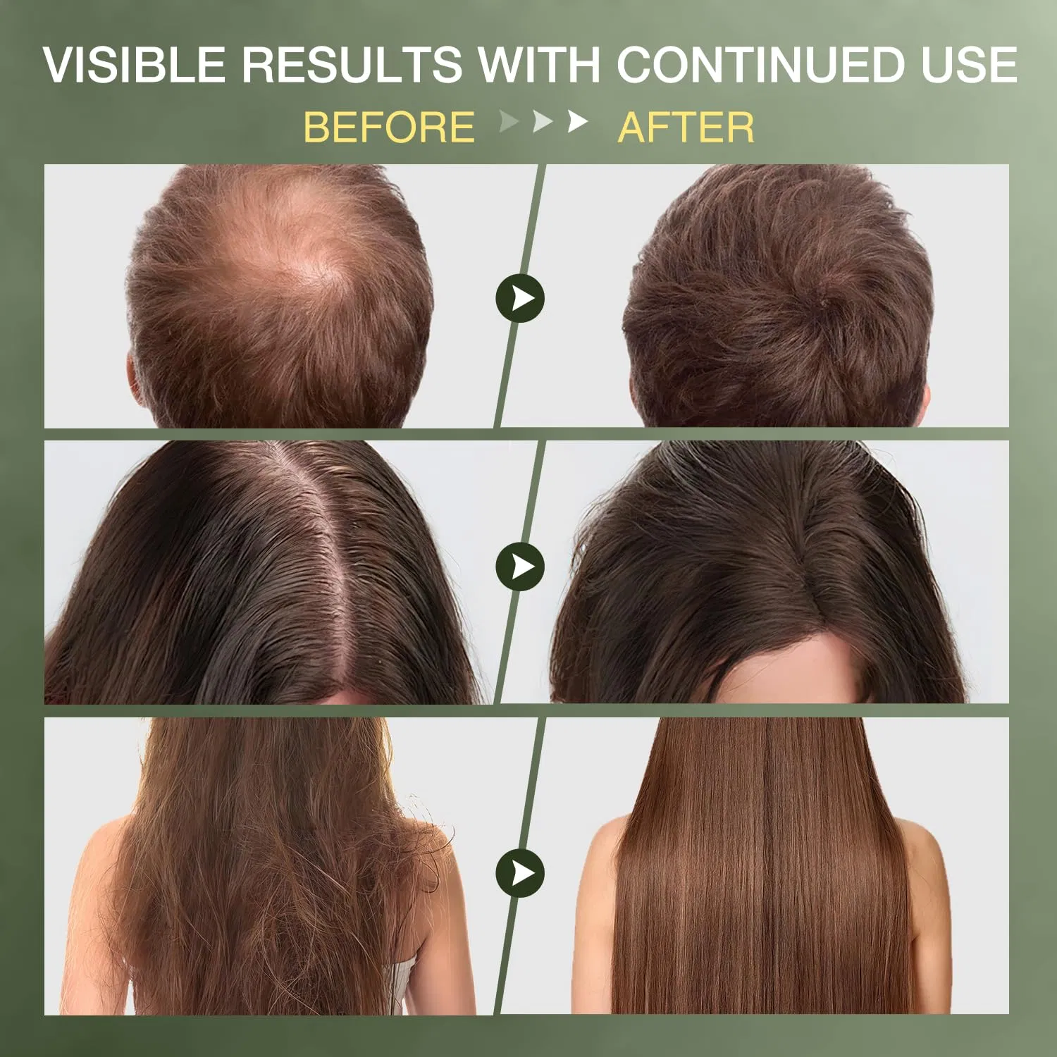 Beauty Cosmetics Skin Care Natural Advanced Hair Growth Prevents Hair Loss Conditioner