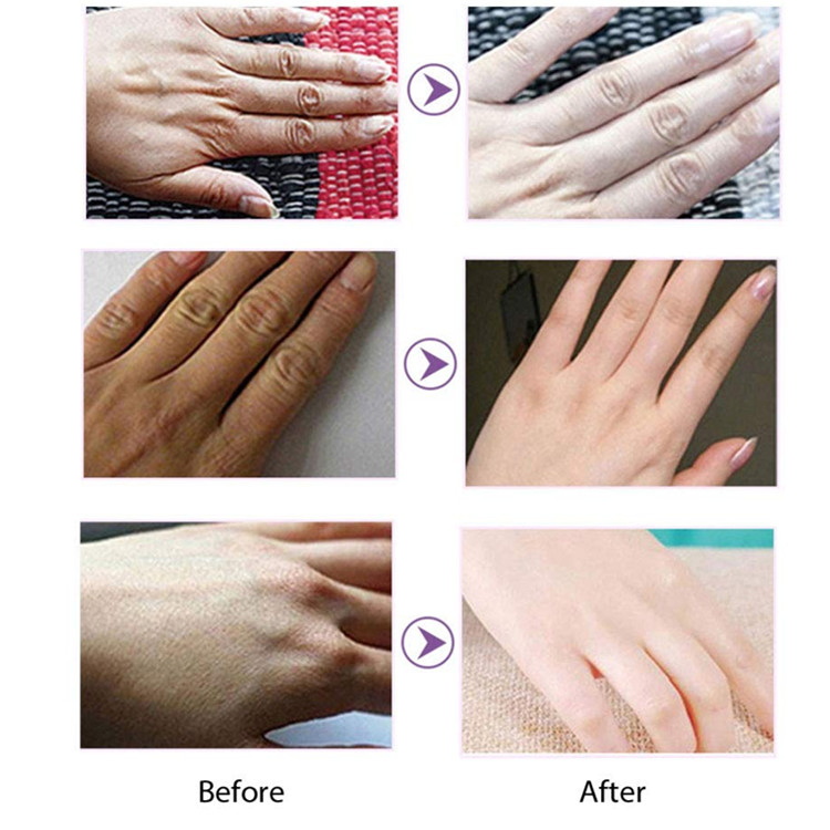 Private Label Moisturizing Exfoliating Whitening Hand Mask