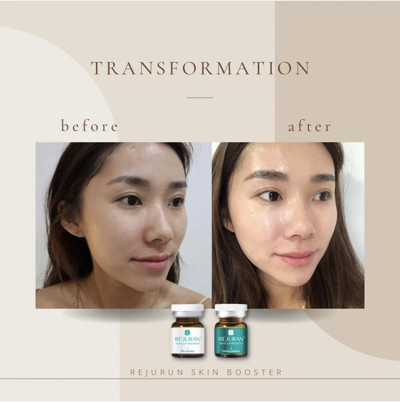 Buy Original Korea Rejuran 3+3 Skin Booster for Anti-Ageing