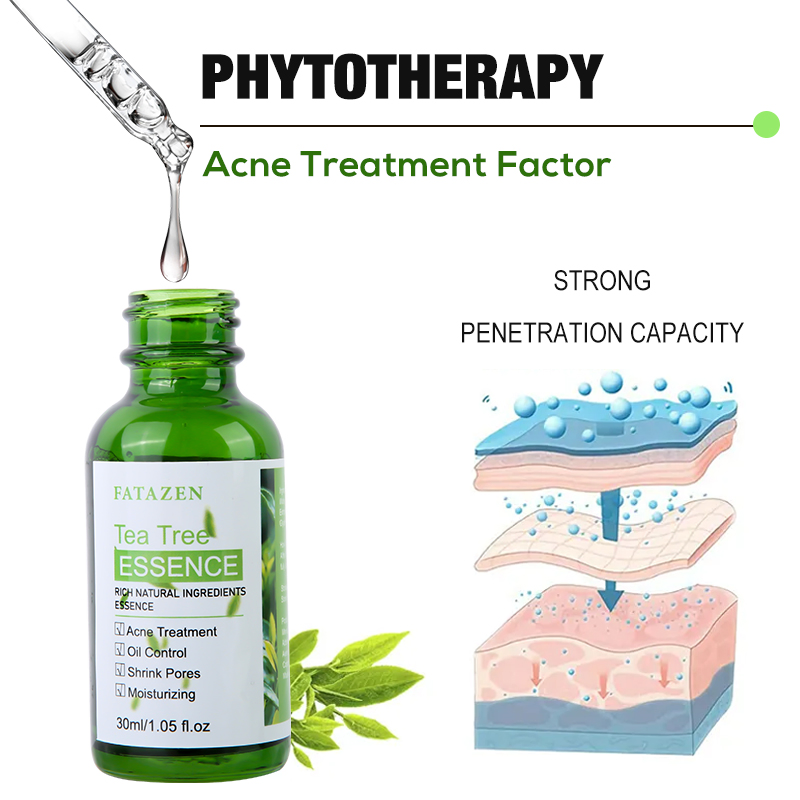 Brightening Green Tea Tree Anti-Acne Serum Whitening Hydrating Skincare Facial Essence