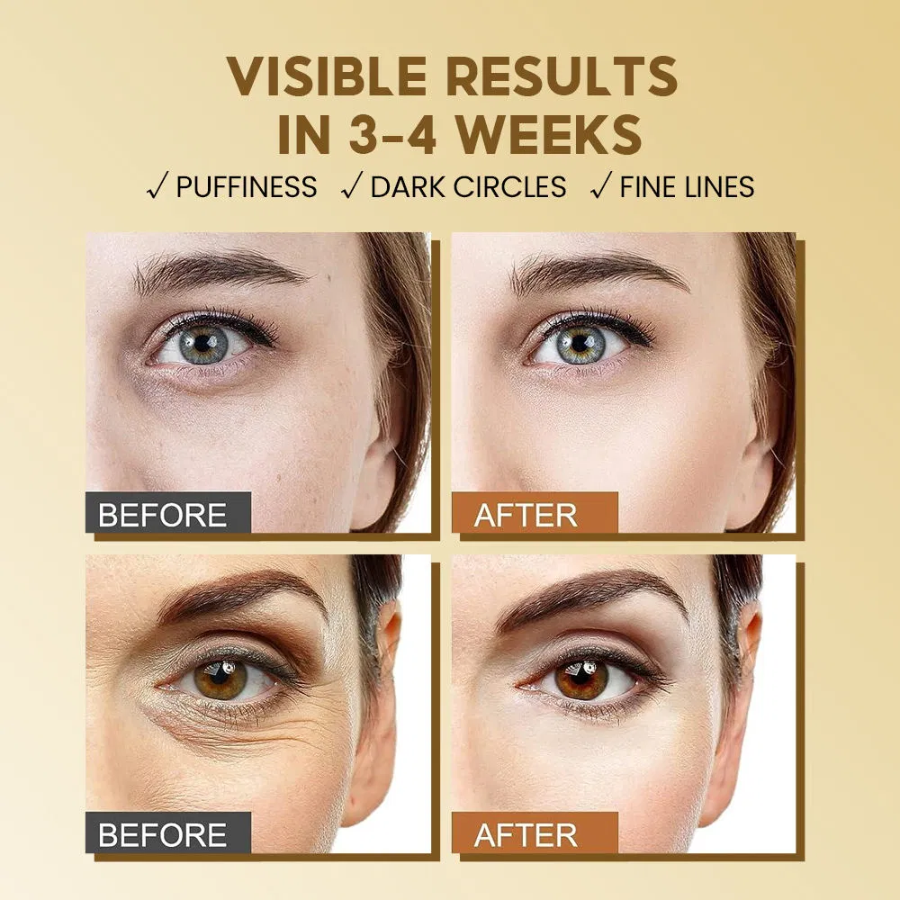 Retinol Eye Stick Anti-Aging Wrinkle Removal Cream for Under Eye Dark Circles