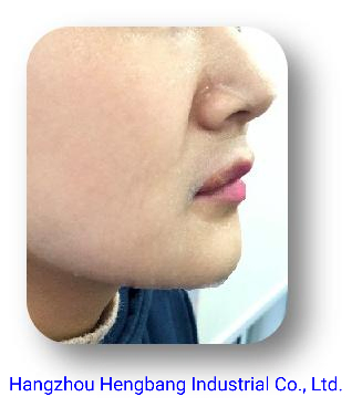 Oblique Patterned Sheet Mask