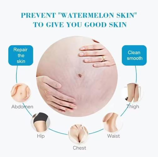Hot Selling Private Label Snail Effectively Remove Stretch Marks Cream