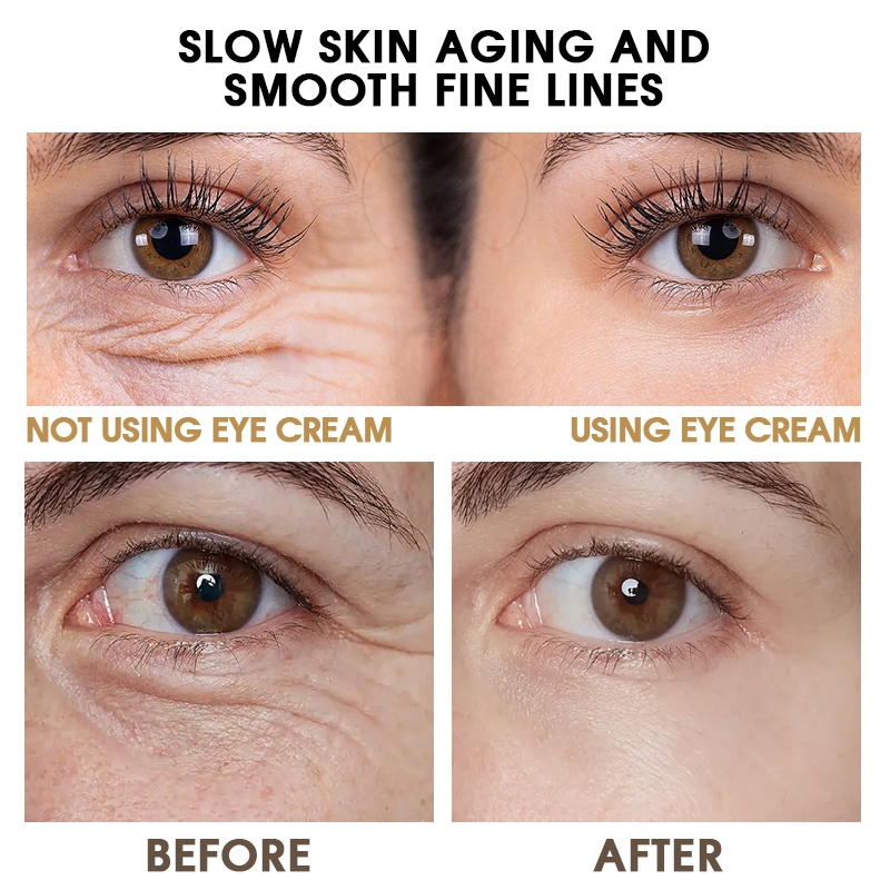 Yeast Repairing Eye Cream Lifting Firming Moisturizing OEM Dark Circles Anti-Wrinkle Elasticity
