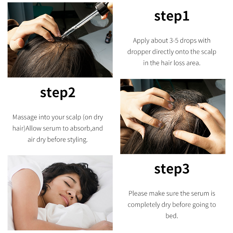 Deep Nourishing Scalp Activate Hair Follicle Unclog Pores Hair Growth Essential Oil