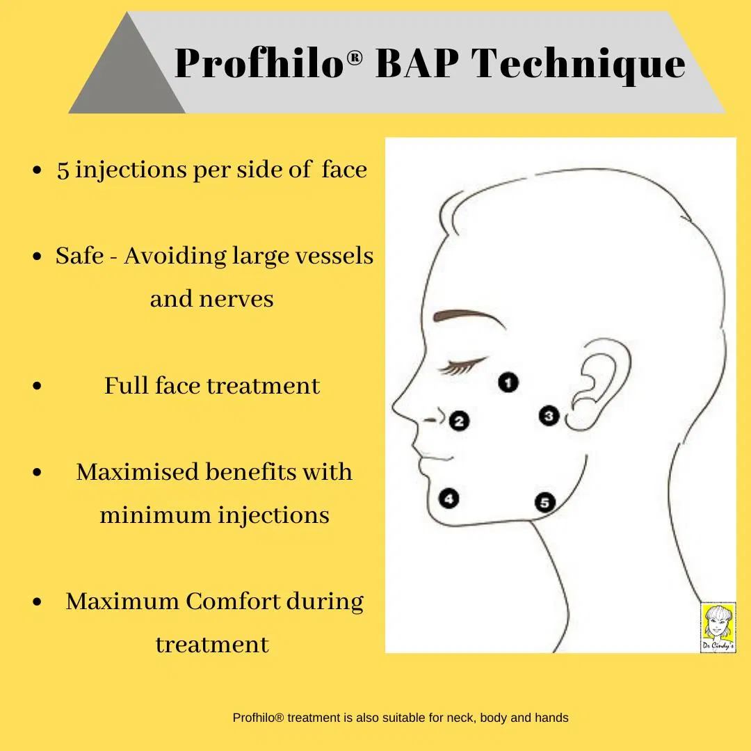 Wholesale Safe and Effective Face Lifting H+L Ha Molecular Profhilo Injectable Dermal Filler Profhilo for Winkle Removal
