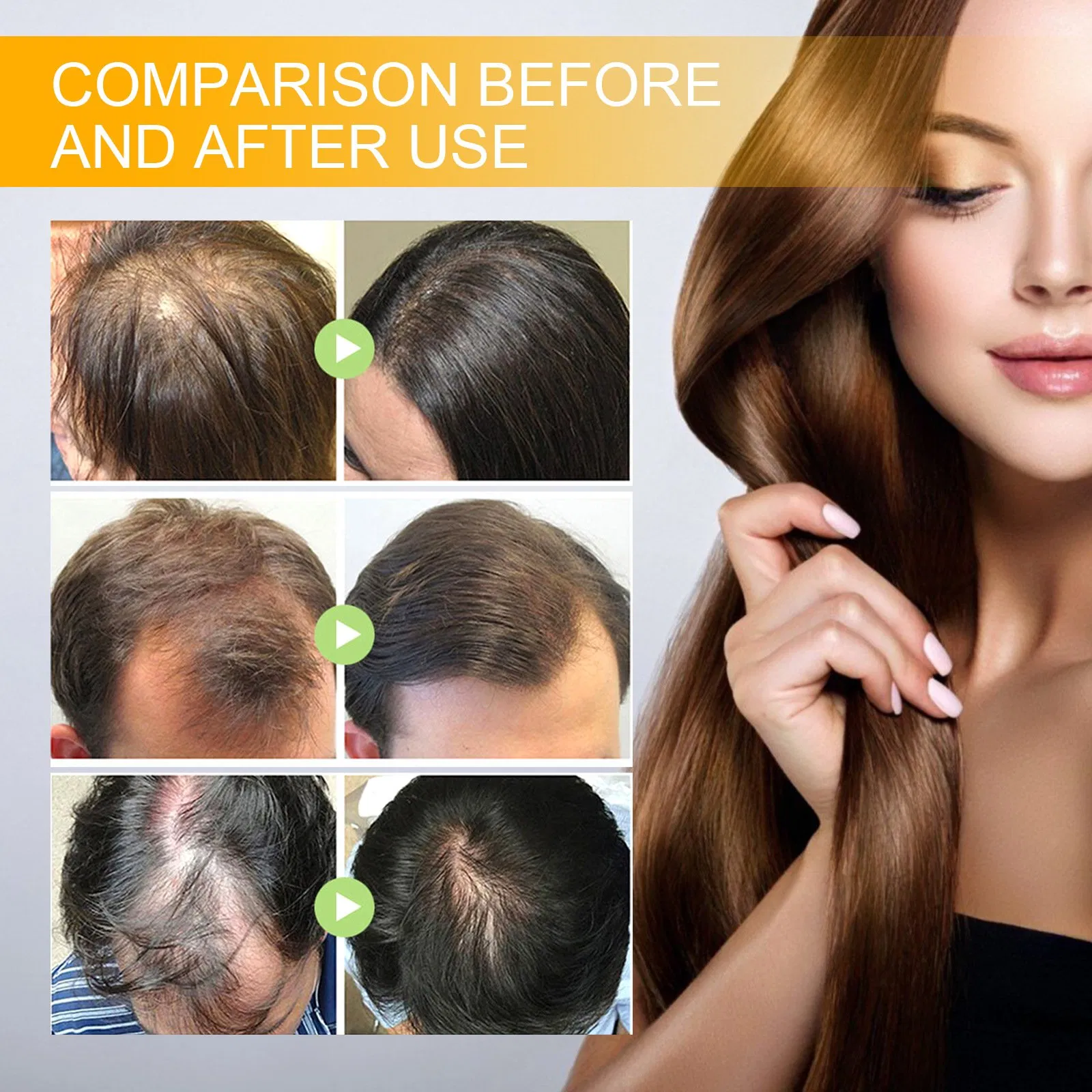 Wholesale Anti Hair Loss 100% Natural Organic Private Label Hair Care Products 30ml Hair Growth & Conditioning Essential Oil