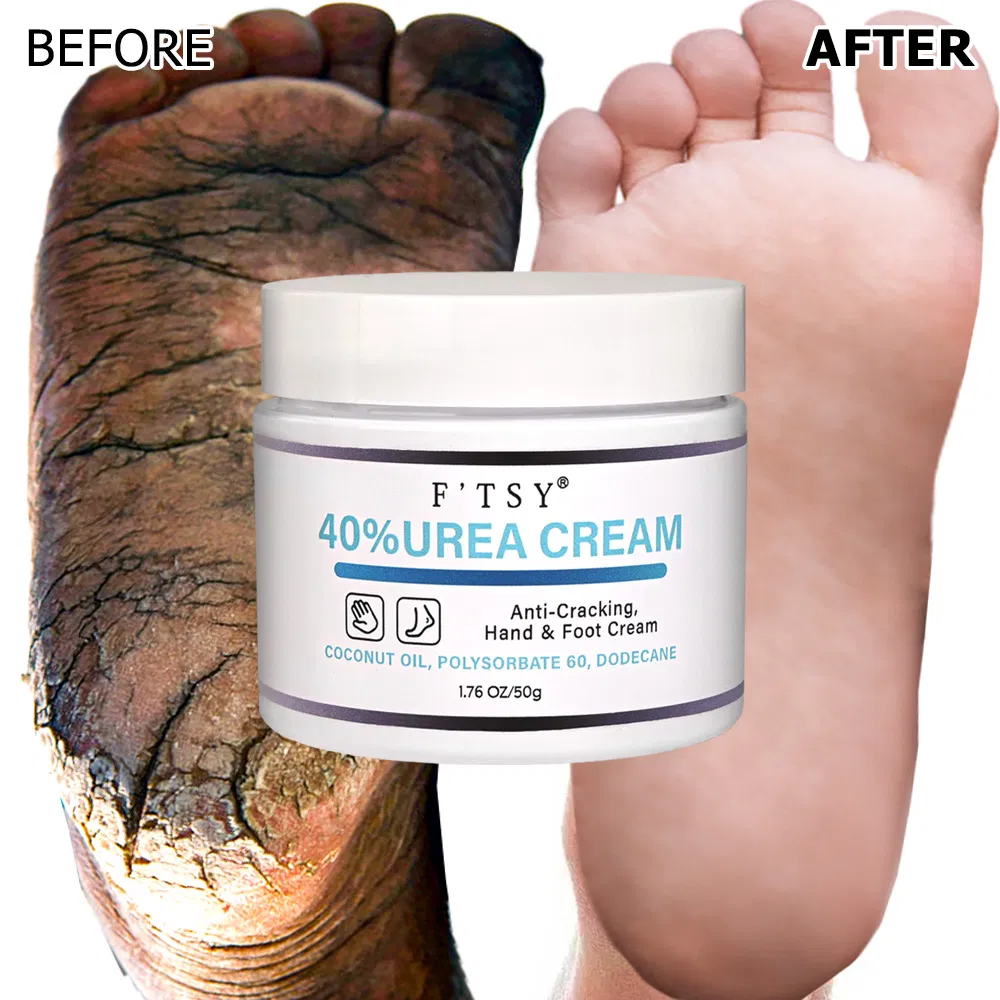 Custom Wholesale Vegan Nourishing Han Foot Urea Cream Shea Butter Anti Cracking Moisturizer