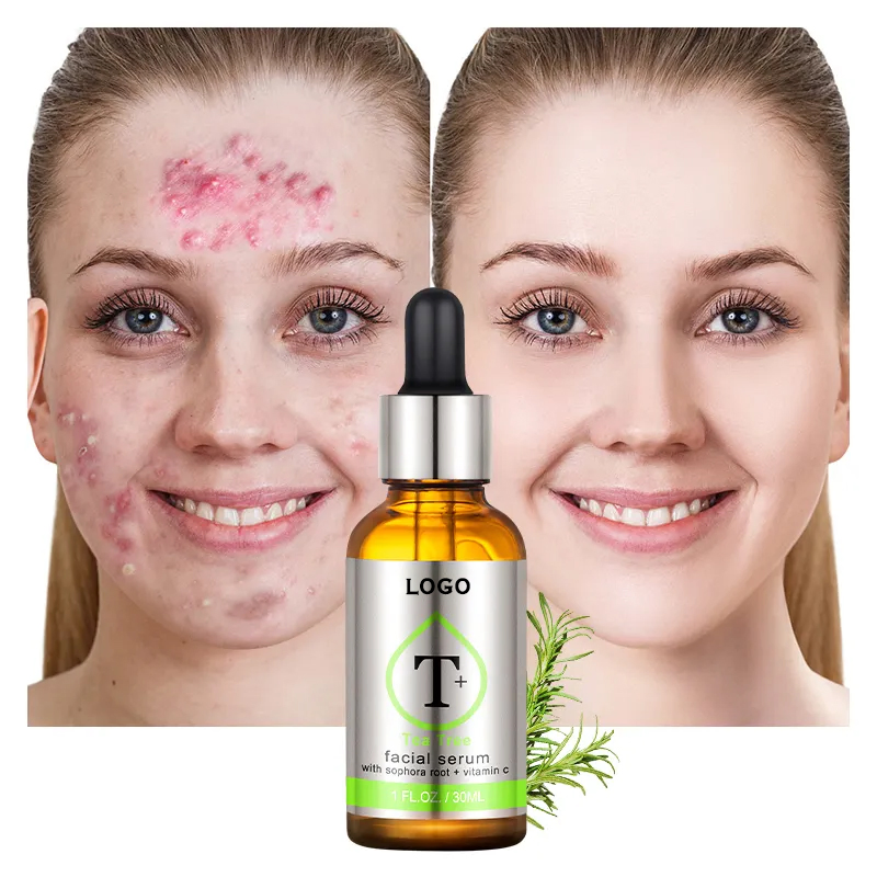 Factory Sales Face Care Whitening Anti Aging Retinol Vitamin C Serum for Face