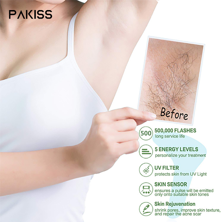 Freezing Point Hair Removal Device Portable IPL Hair Removal Machine for Home Use