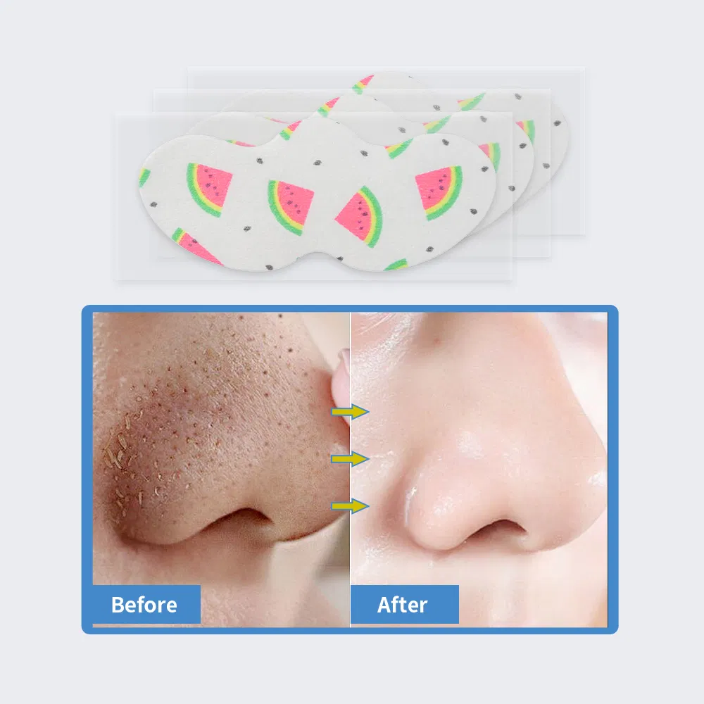 Charcoal Nose Strips with Aloevera Extract, Blackhead, Whitehead Remover, Pores Cleanser, Dirt Free,