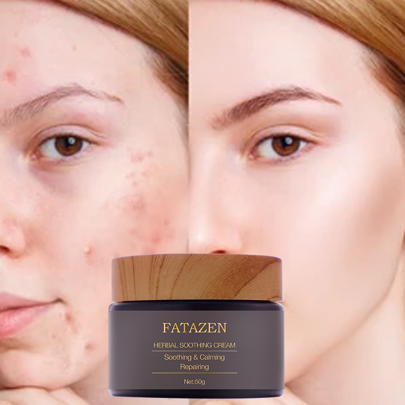 Calming Repairing Face Women Skin Care Product Recover Natural Herbal Soothing Cream