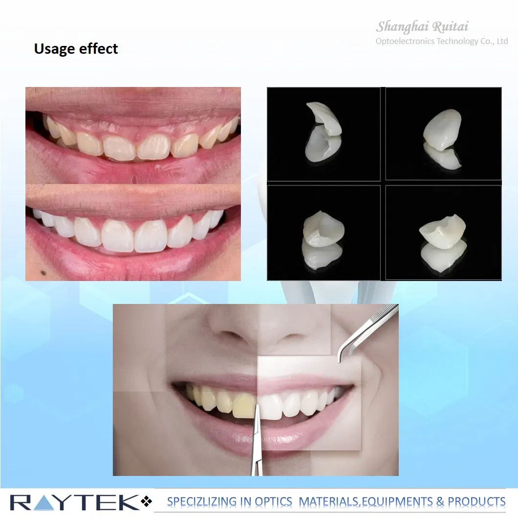 Advanced Inert Dental Glass for Durable Fillings and Restorations