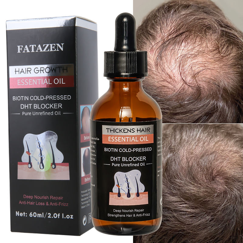 Fatazen Hair Growth Serum Oil Biotin Regrowth Treatment for Scalp Hair Loss Thinning Hair Growth Serum for Men Women