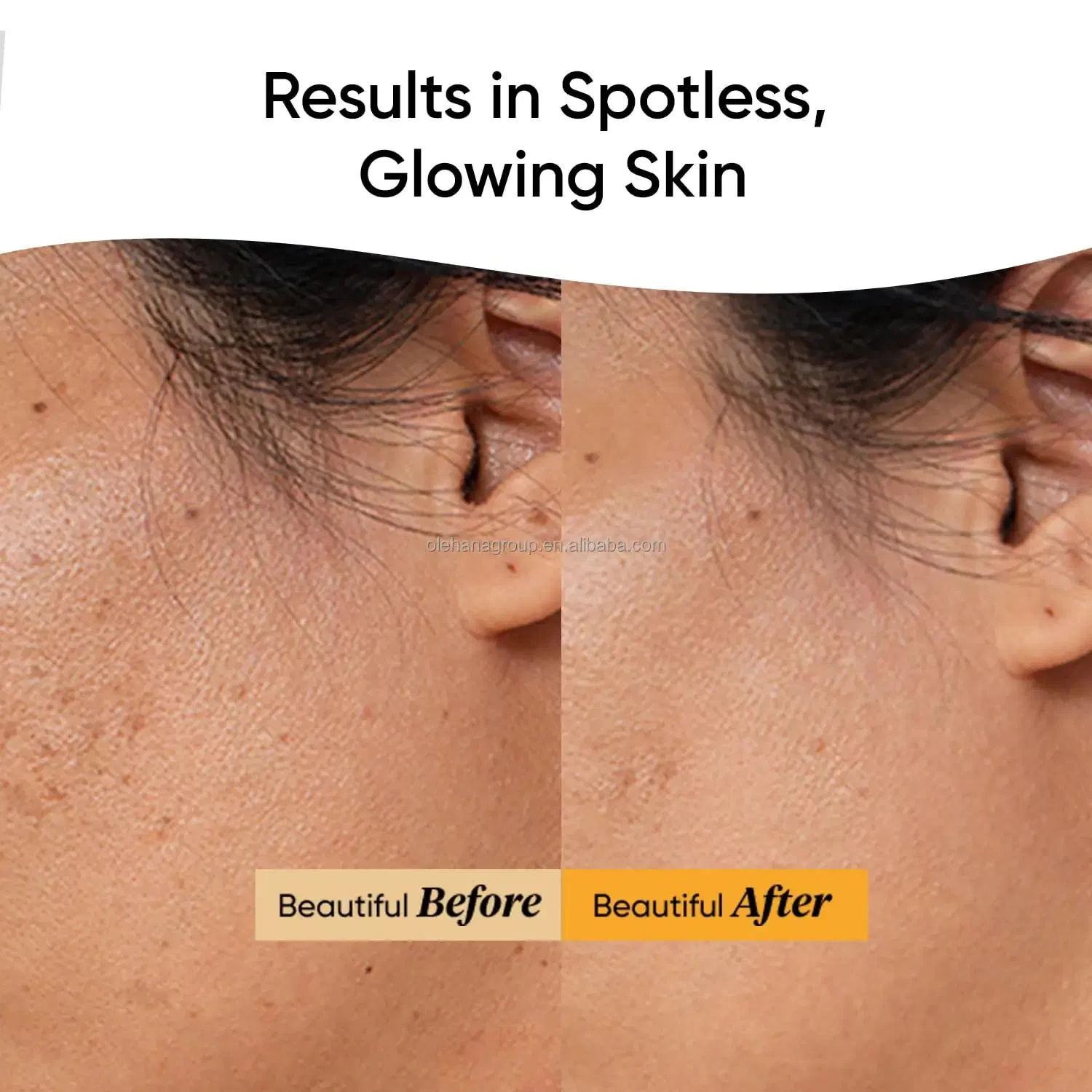 Wholesale Advanced Moisturizer Anti Aging Facial Serum Hyaluronic Acid Essence 30ml Vitamin C Face Serum for Glowing Skin