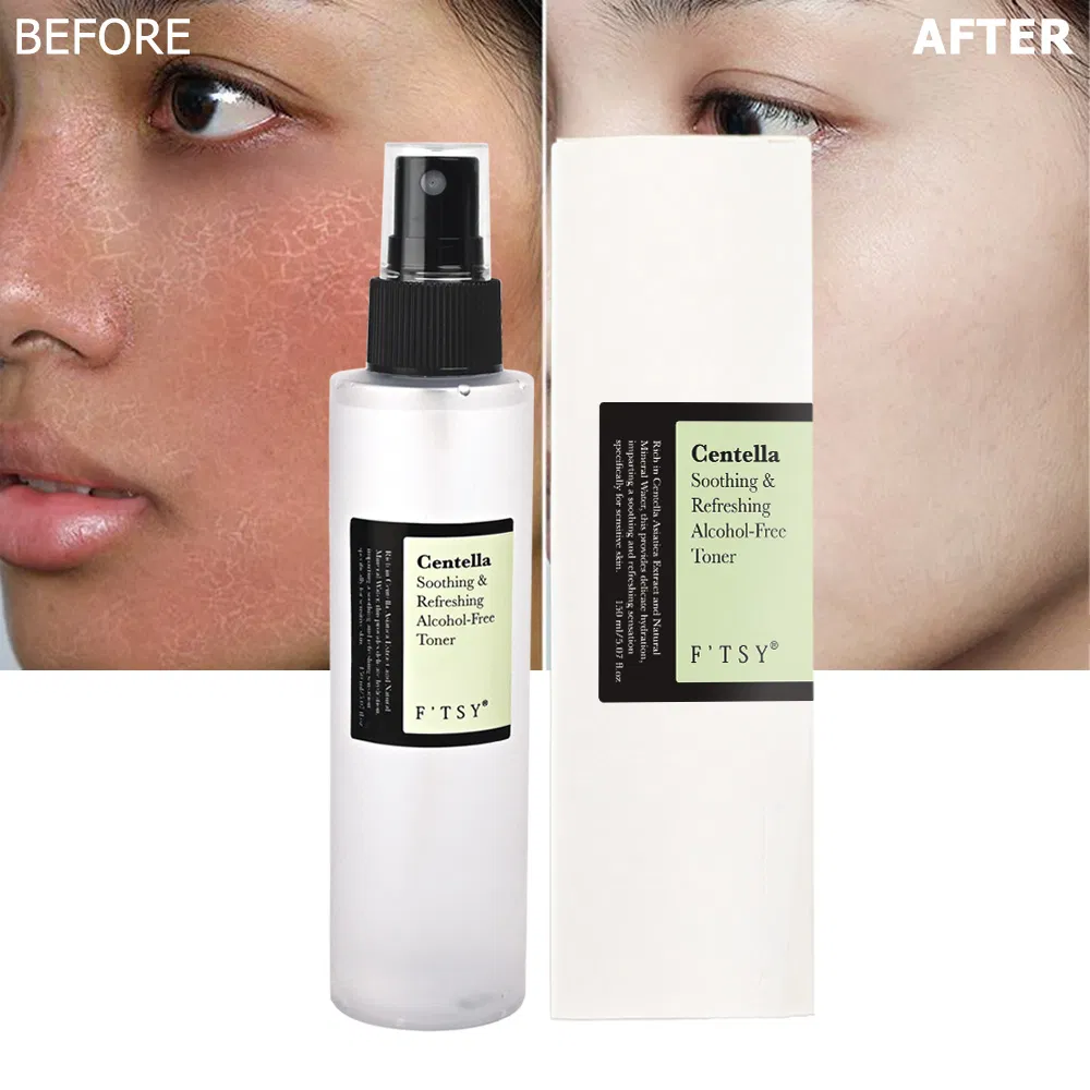 Factory Directly Price Anti Aging Centella Soothing Refreshing Alcohol-Free Toner Private Label