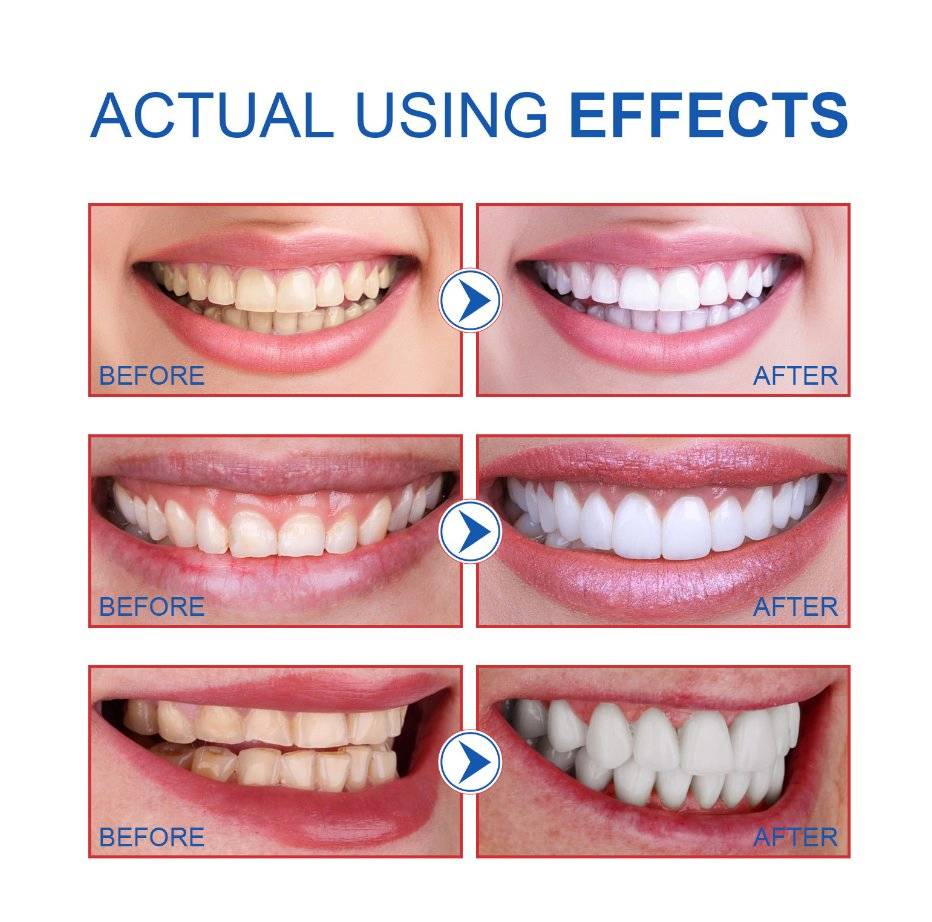 Отбеливающая зубная паста SP-6 Probiotic, 120г