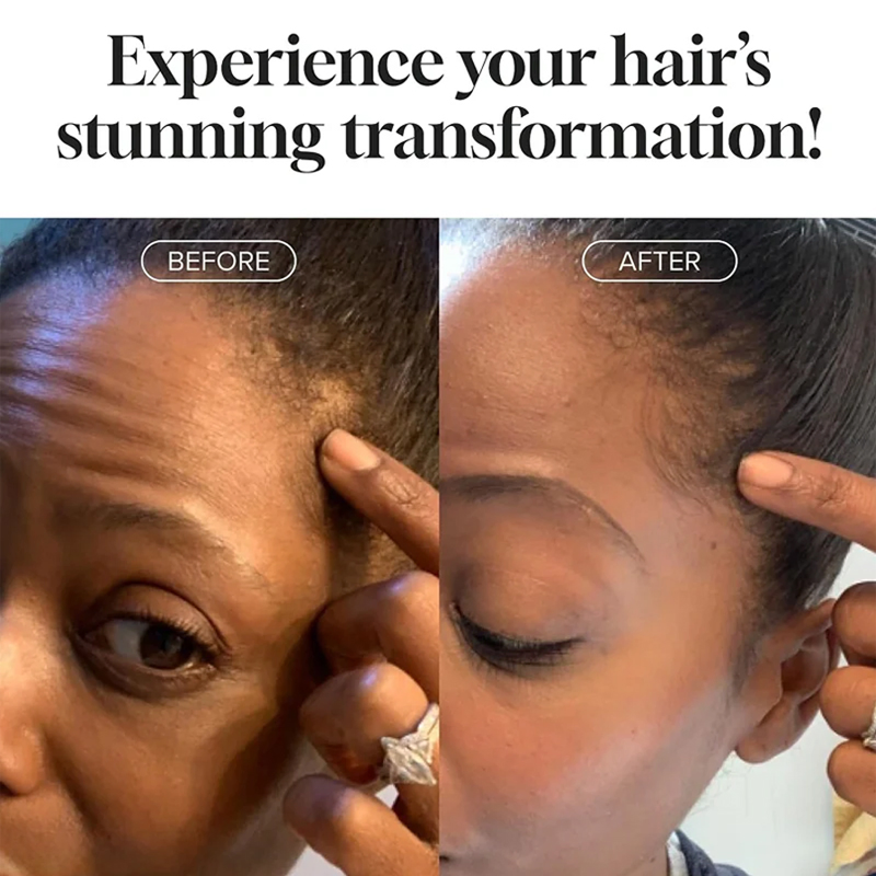 Ditong OEM/ODM Shampoo and Conditioner for Hair Loss Prevention