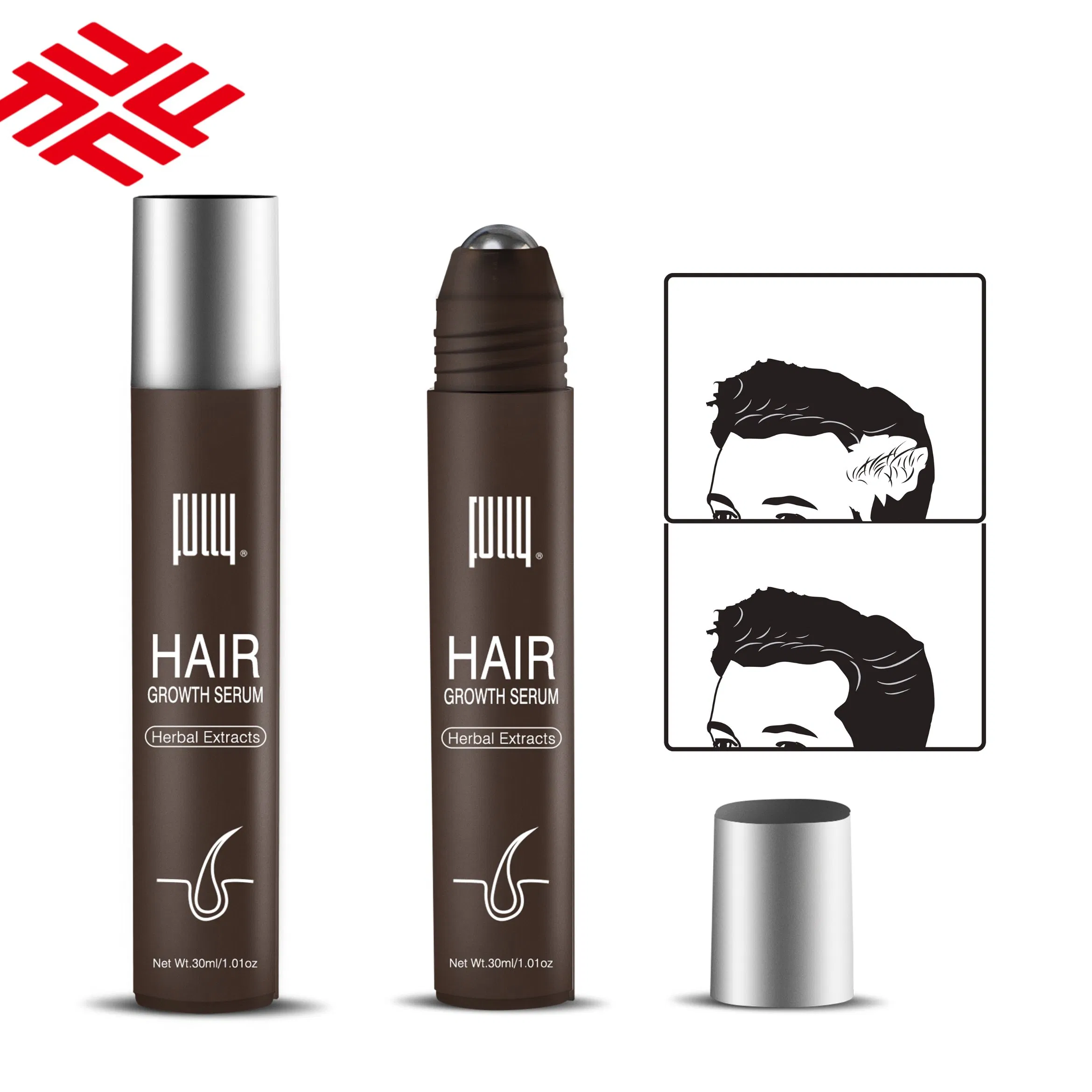 Professional Manufacturer Supplier Fully Hair Growth Serum Anti Hair Loss Treatment