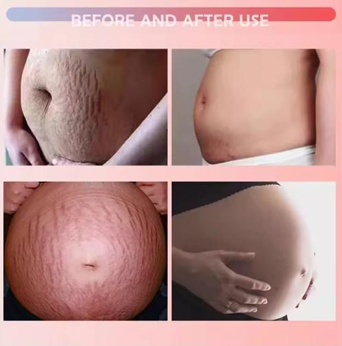300g Stretch Marks Rose Massage Cream Body Lotion