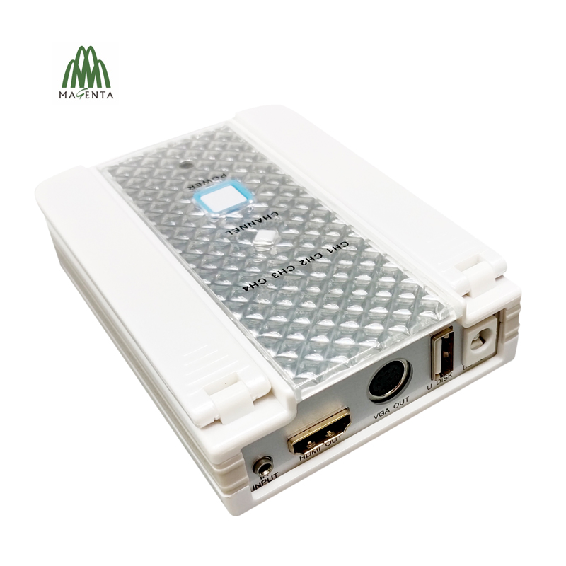 1080P HD Intraoral Dental Camera for TV Screen Display