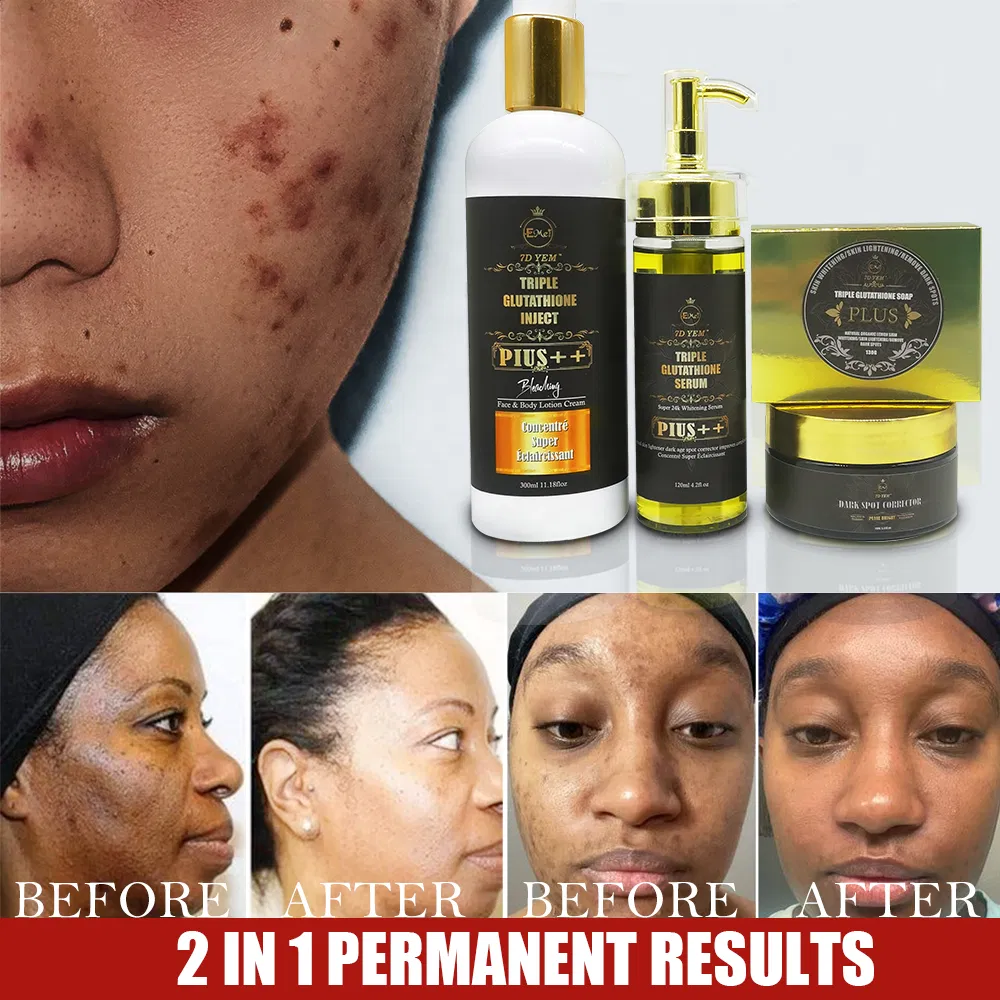 High Quality OEM Independent Brand Moisturizing Whitening Acne Removing Black Spot Removing Glutathione Skin Whitening Set