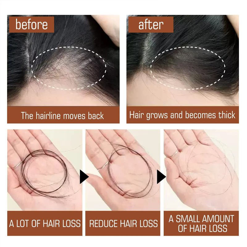 Ditong Natural Organic Moisturizing Repair Root Soft Strong Fluffy Batana Oil for Hair Growth