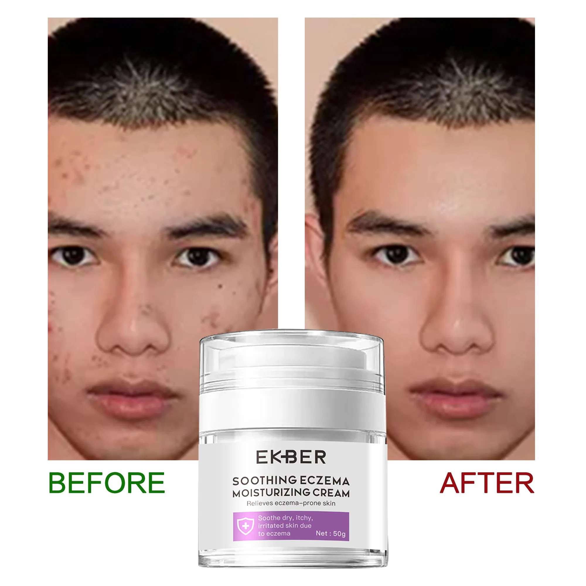 Private Label Soothing Eczema Moisturizing Cream Chinese Herbal Moisturizer Relieves Eczema-Prone Skin