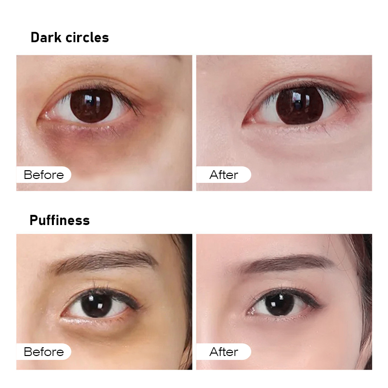 High Quality OEM/ODM Freeze-Dired Eye Mask Reduce Eye Puffiness Moisturizing Skincare Mask Whitening Under Eye Mask Wholesale