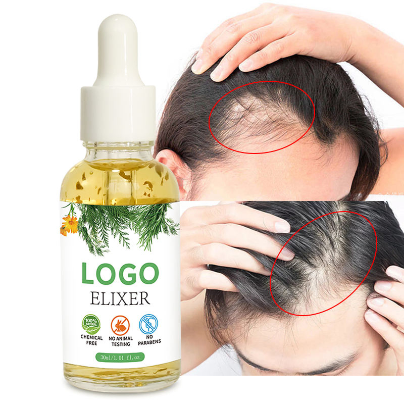 Private Label Rosemary All Natural Formula Hair Growth Oil Serum Nourishing Green Tea Nourishes Scalp Rapid Organic Elixer Oil