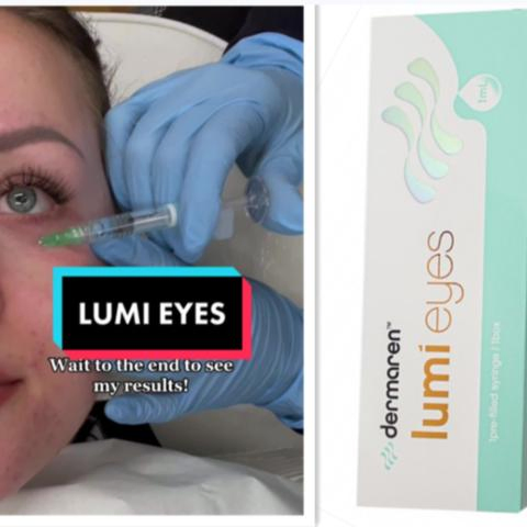 Korea Dermaren Lumi Eyes Eye Bag Black Circletreatment Pdrn Anti-Aging Wrinkles Skin Whitening Rejuvenation with Best Price