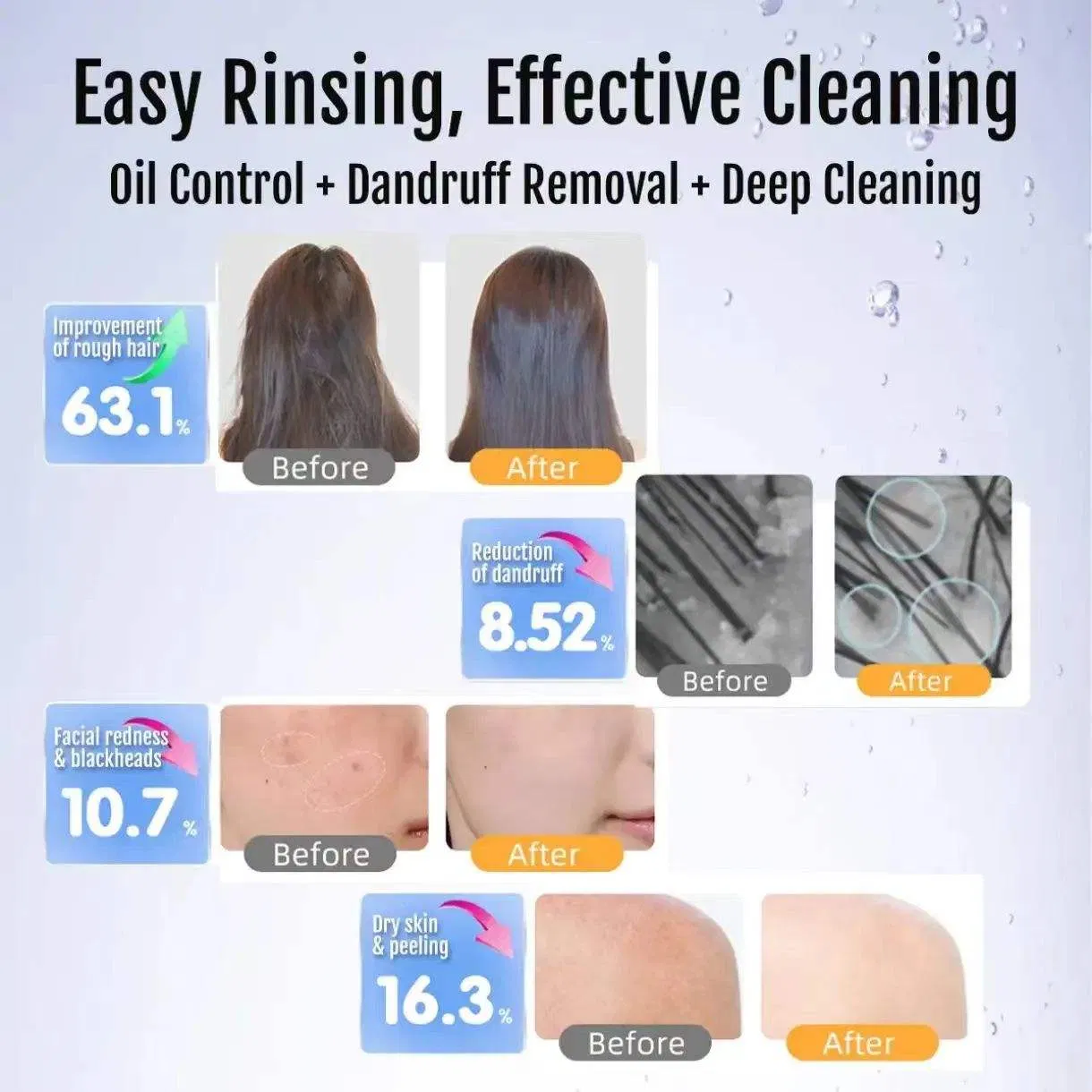 Shower Aeratpor Making Micro Nano Bubble Deep Clean Skin & Hair Remove Chlorine Installled in Shower Head in Bathroom