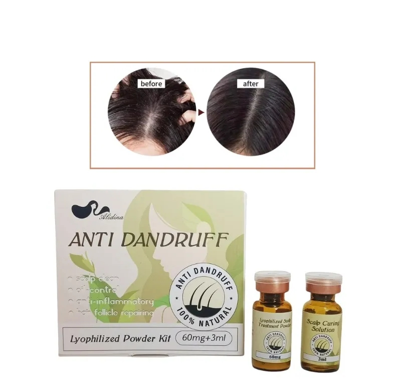 Anti-Dandruff Cleaning Scalp Freeze-Dried Powder Anti Hair Loss