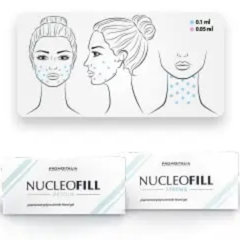 Hot Selling Face Lifting Injection Nucleofill Strong Pn 2.5% Polynucleotides Face Eye Anti Wrinkle Skin Booster Collagen Injection Profhilo H+L Nucleofill