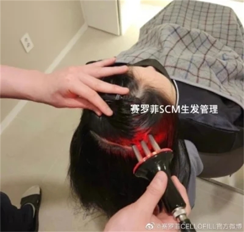 Korean Scm Stem Cell Hydrography Acne Removal