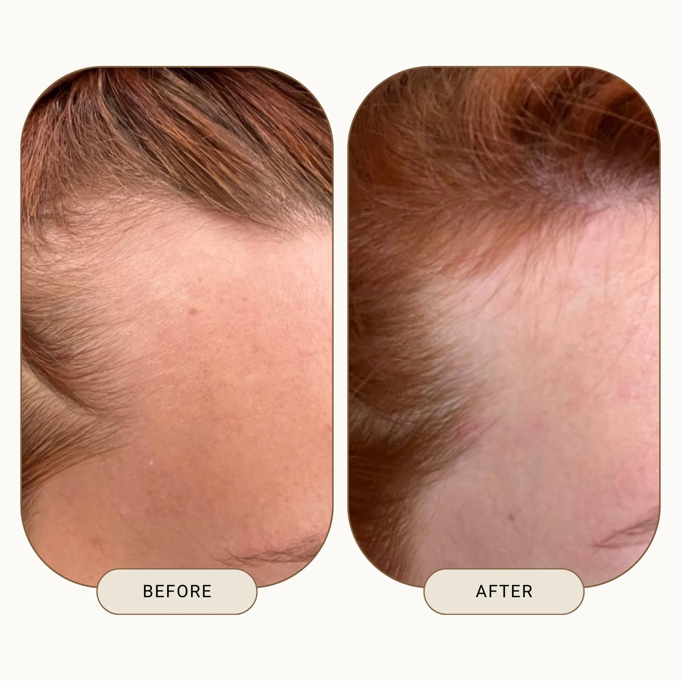 Private Label Natural Organic Rosemary Hair Growth Oil Hair Regrowth Treatment Scalp Care Massage Hair Growth Serum Oil