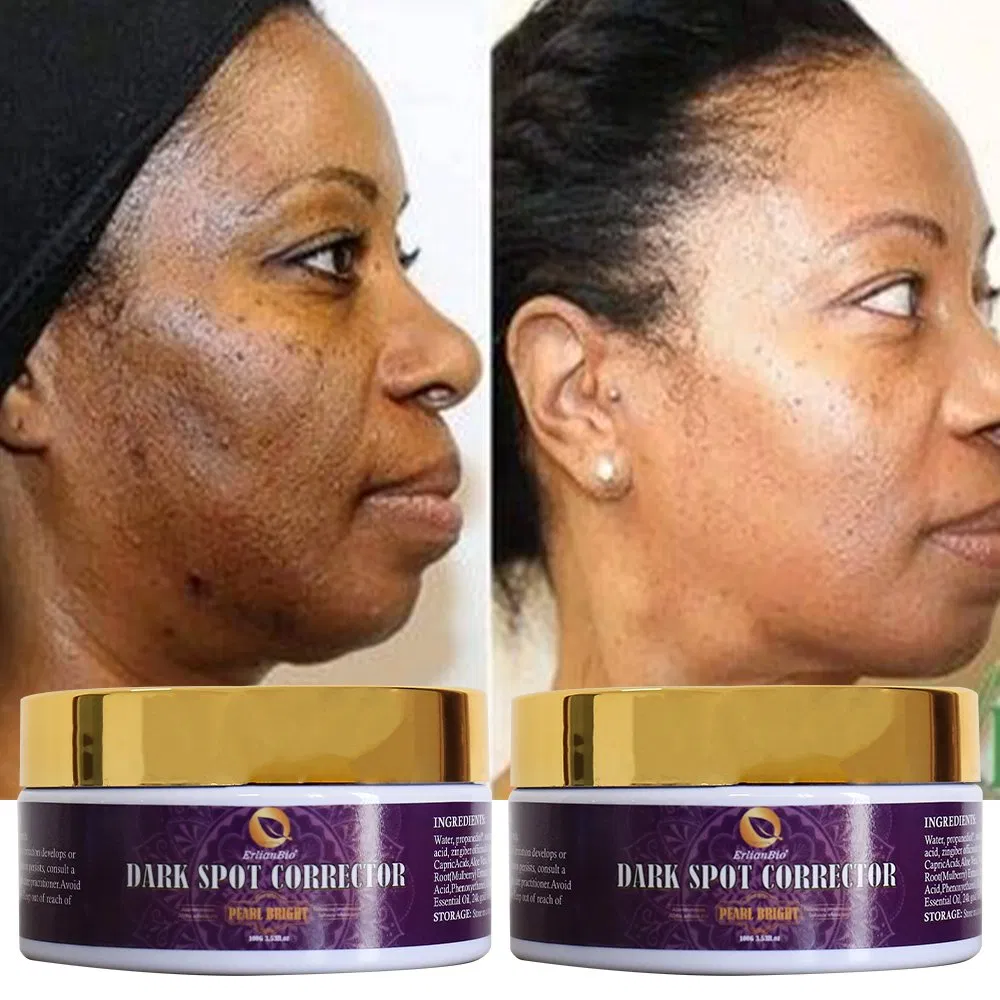 Hydrating Anti Dark Spot Whitening Lemon Face Cream for Adults Aloe Moisture Anti Aging Brighten Skin Cream