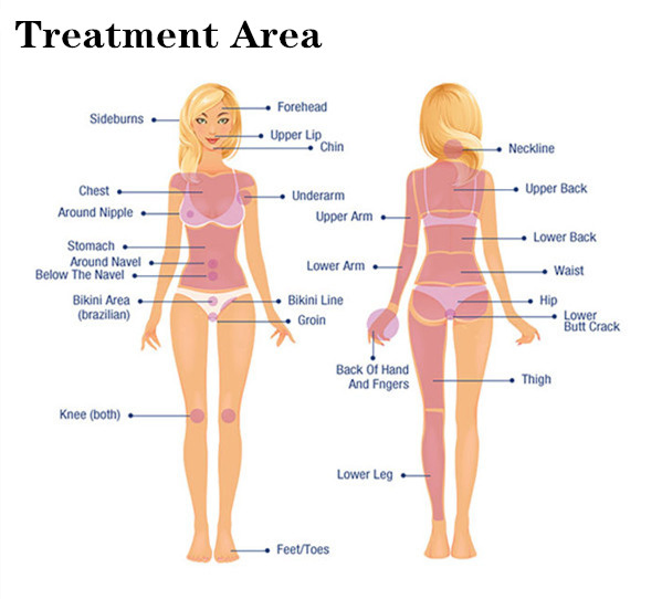 Q Switch ND YAG Laser Diode Machine Body and Neck Throat Hair Removal Skin Rejuvenation Firming Moisturizer Pore Cleaner