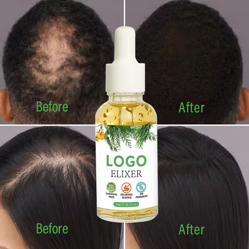 Private Label Rosemary All Natural Formula Hair Growth Oil Serum Nourishing Green Tea Nourishes Scalp Rapid Organic Elixer Oil